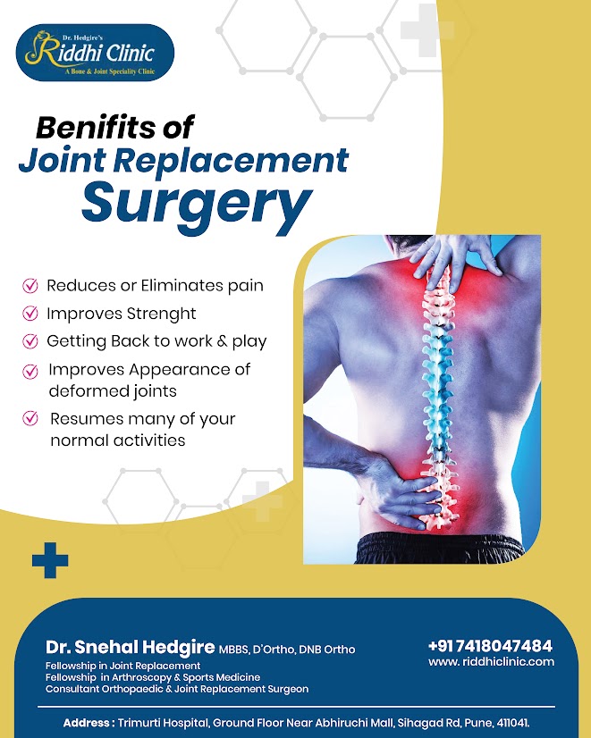 Joint Replacement Surgery